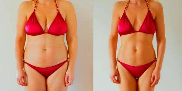 Mide Balonu Gerçekten İşe Yarıyor mu