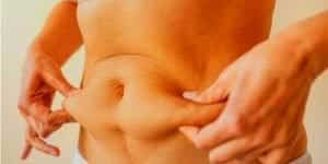 Tüp Mide mi, Gastrik ByPass mı
