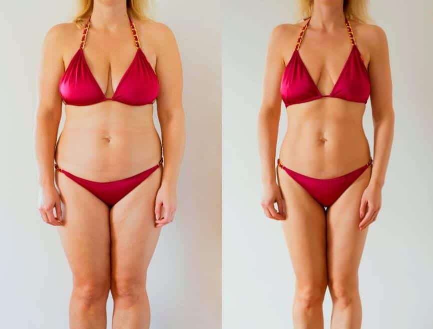 mide balonu işe yarıyor mu